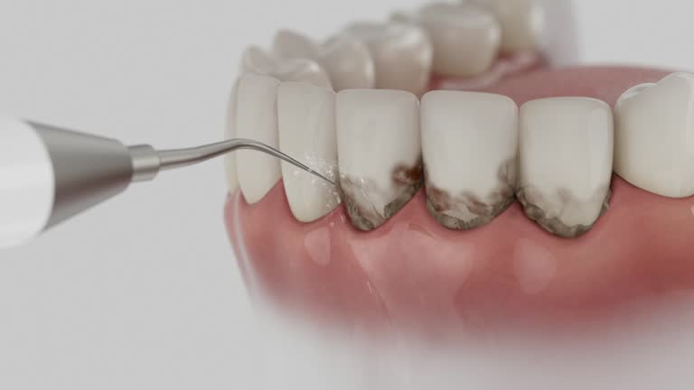 Reliable Dental contractor in Botkins, OH by Dentist Open Now